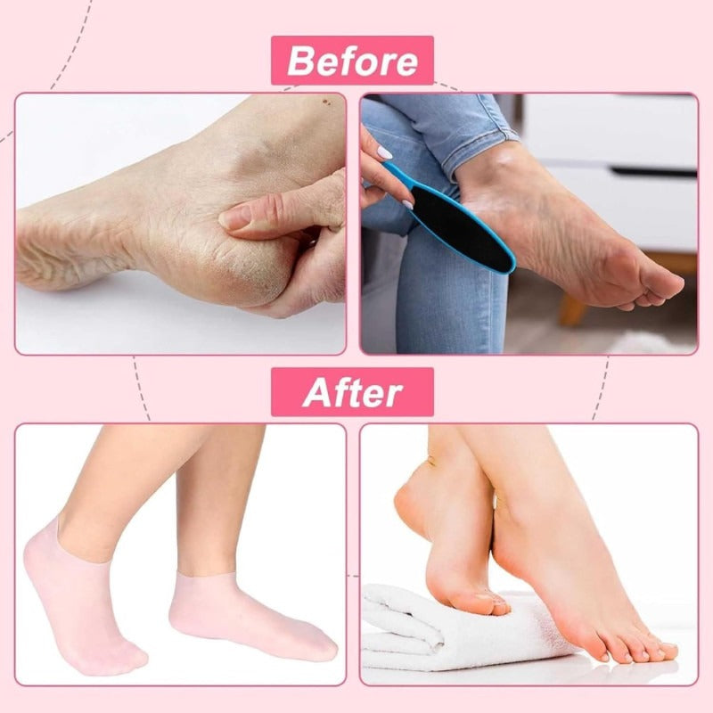 Silicone Socks Silicone Gel Sock Silicone Moisturizing Sock Silicone Heel Sock ( Pack of 2 )